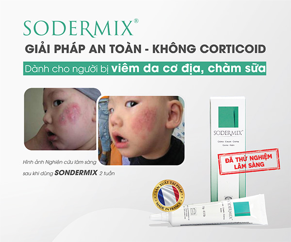 5. Sodermix - giải pháp không Corticoid cho viêm da cơ địa, chàm sữa 1