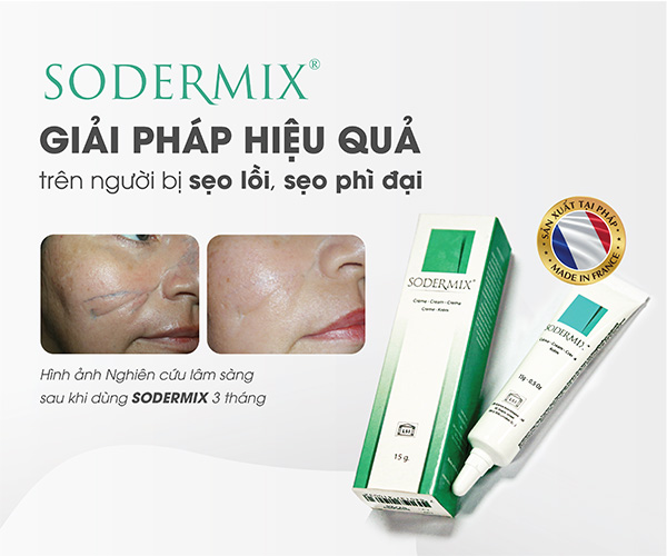 Sử dụng Kem trị sẹo Sodermix 1