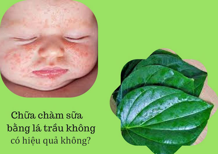 Chữa chàm sữa bằng lá trầu không có hiệu quả không? 1