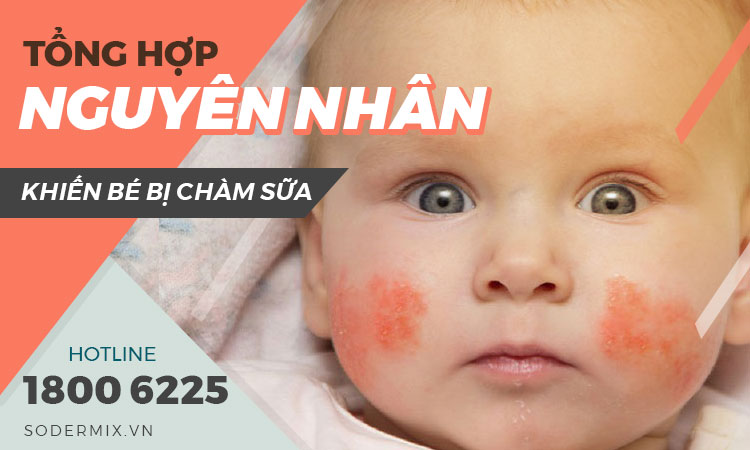 Tổng hợp nguyên nhân khiến bé bị chàm sữa