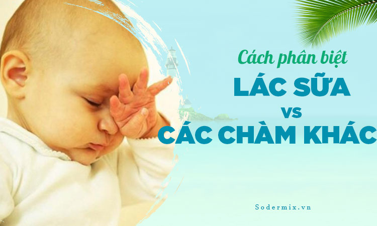 Cách phân biệt lác sữa với các loại bệnh chàm khác