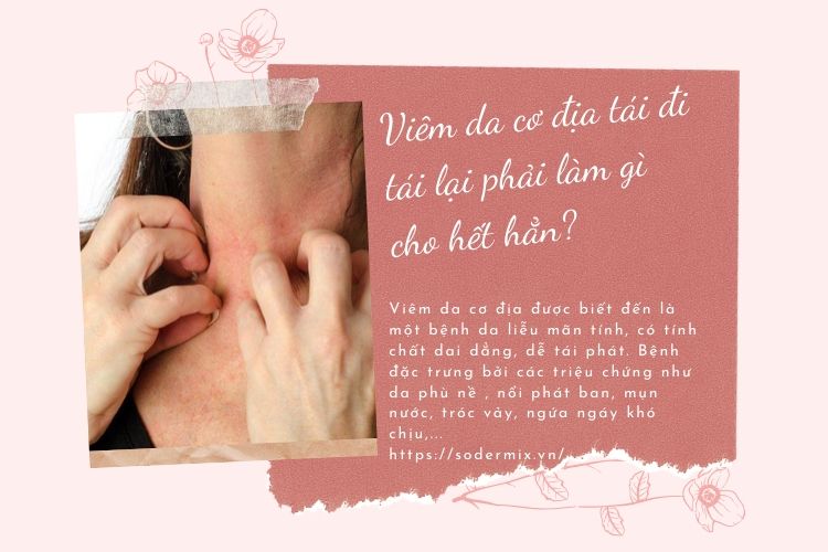 Bệnh viêm da cơ địa tái đi tái lại phải làm gì cho hết hẳn? 1