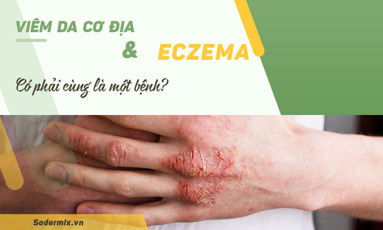 Viêm da cơ địa và eczema có phải là một bệnh ?