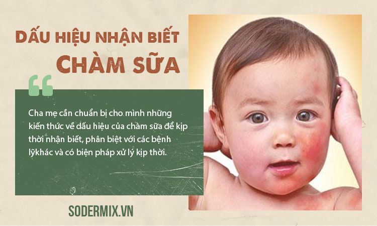 Dấu hiệu chàm sữa giúp mẹ nhận biết phân biệt với bệnh khác!