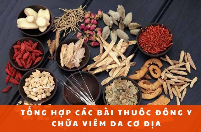 Tổng hợp cách chữa viêm da cơ địa bằng Đông y 1