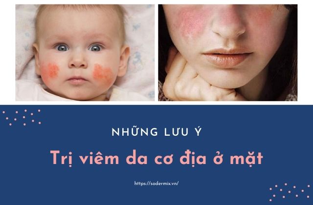 Trị viêm da cơ địa ở mặt cần lưu ý những gì?