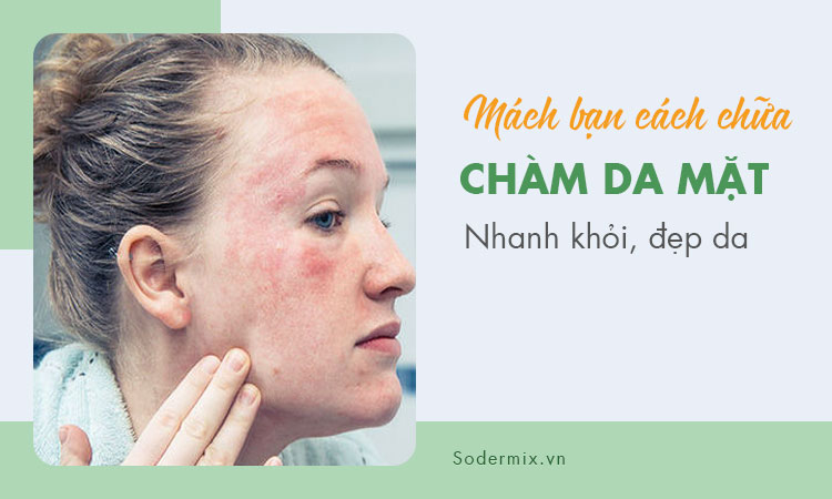 Mách bạn cách chữa chàm da mặt nhanh khỏi, đẹp da