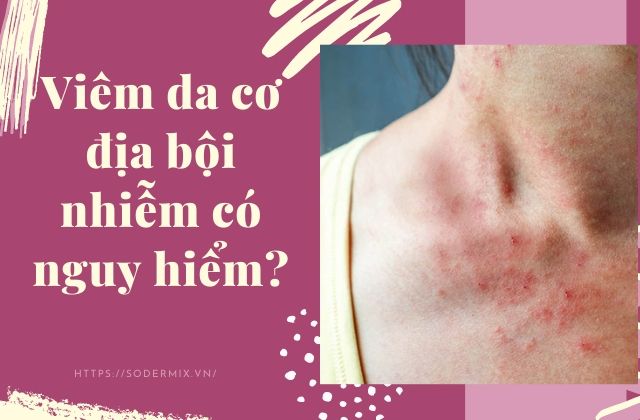 Viêm da cơ địa bội nhiễm có nguy hiểm? Điều trị như thế nào? 1