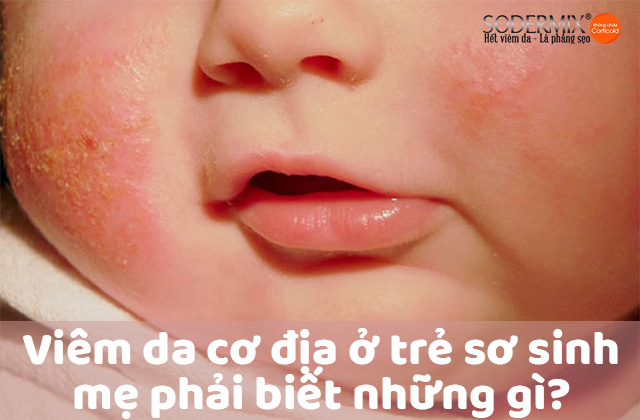 Trẻ sơ sinh bị viêm da cơ địa - mẹ phải biết những gì? 1