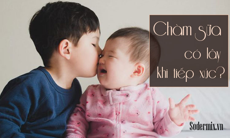 Chàm sữa có lây khi tiếp xúc không?