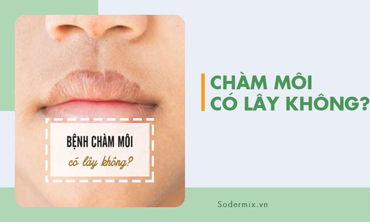 Chàm môi có lây không?