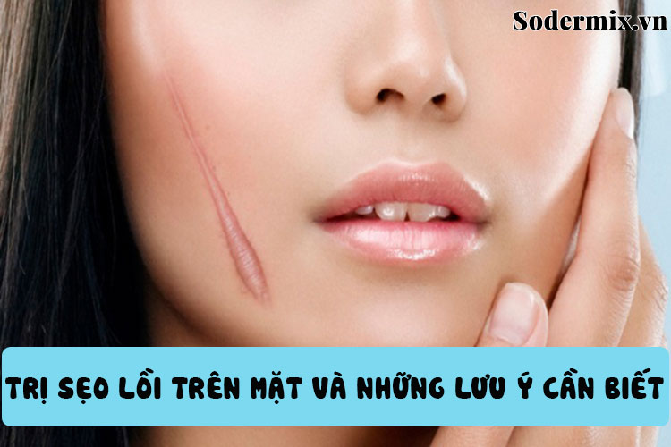 5 Cách trị sẹo lồi trên mặt hiệu quả cùng các lưu ý quan trọng