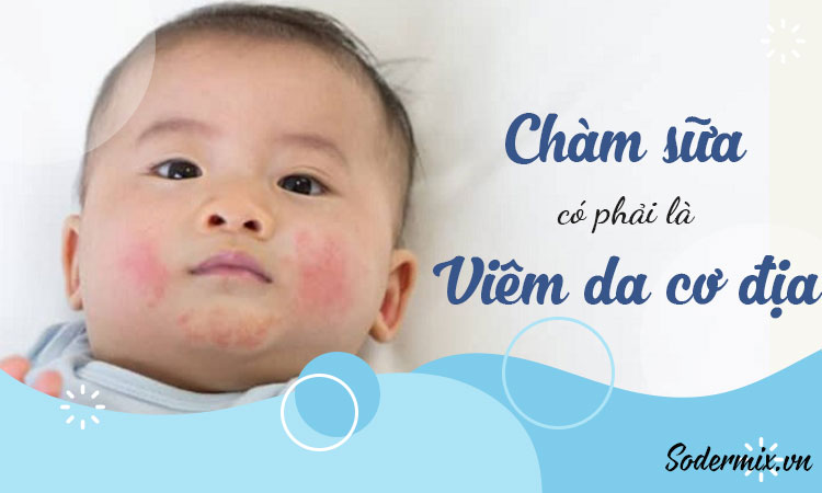 Chàm sữa có phải viêm da cơ địa không?