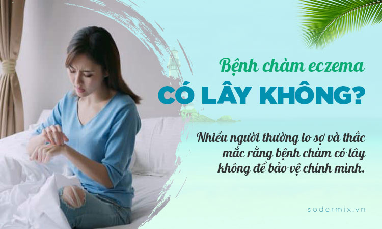 Bệnh chàm eczema có lây không?