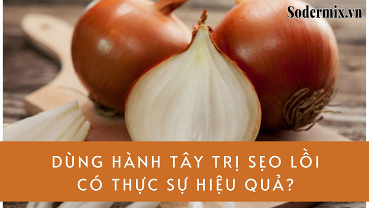 [THẮC MẮC] Hành tây trị sẹo lồi có thực sự hiệu quả?