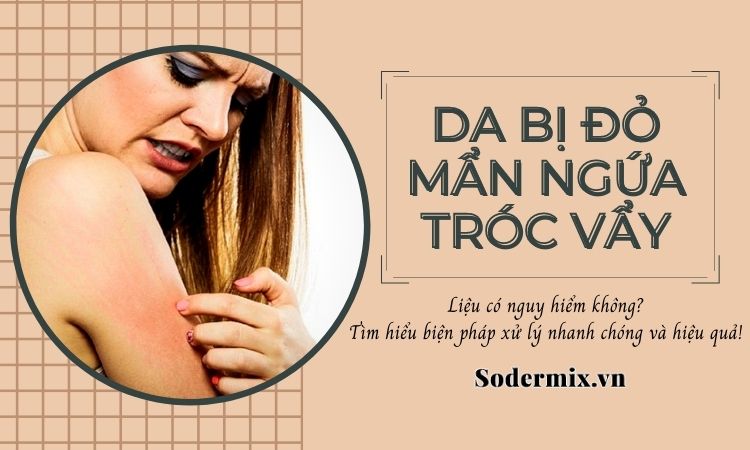 Khắc phục tình trạng da bị đỏ mẩn ngứa tróc vẩy