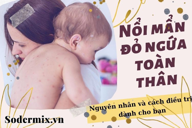 Nổi ban mẩn đỏ ngứa toàn thân do đâu? Giải pháp nào khắc phục?