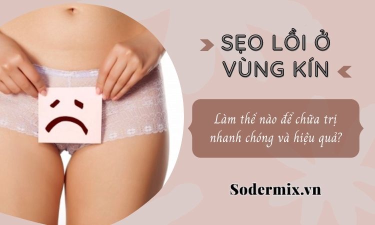 Sẹo lồi ở vùng kín có làm sao không? Cách chữa như thế nào?