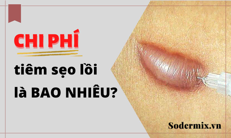 Tiêm sẹo lồi bao nhiêu tiền? Có hiệu quả không?