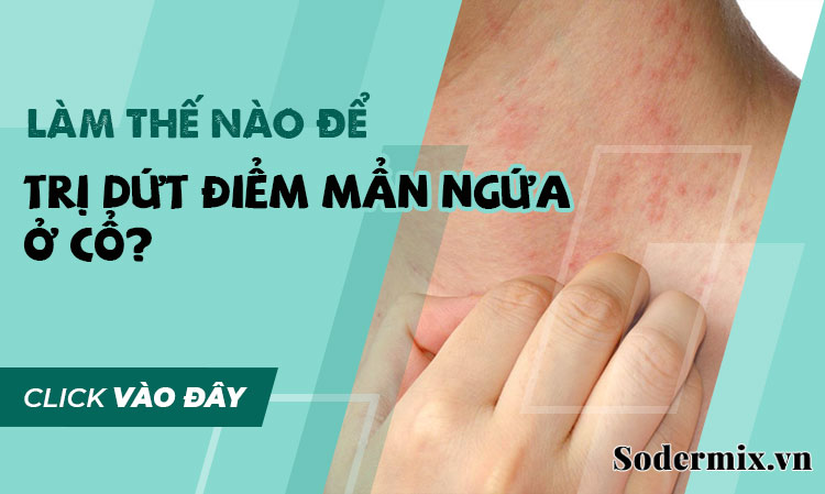 Nổi mẩn ngứa ở cổ phải làm sao để trị dứt điểm?