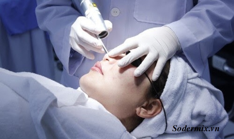 Sử dụng laser điều trị 1