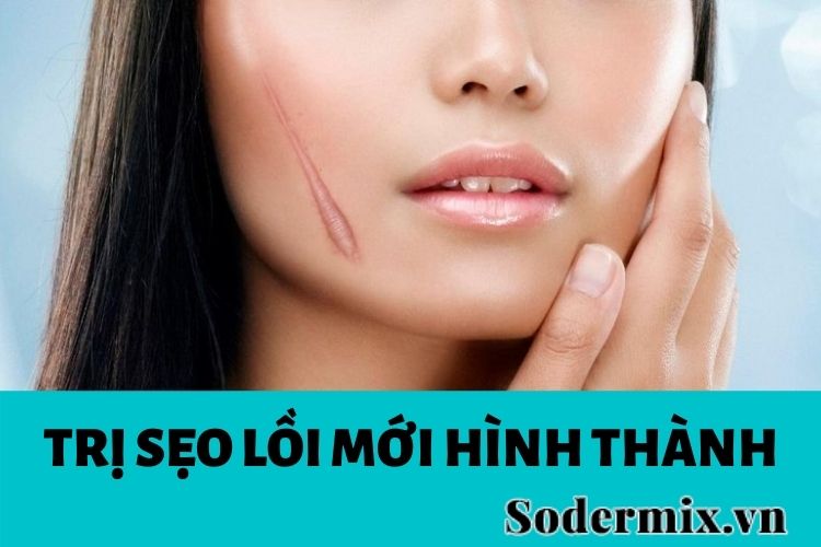 Cách trị sẹo lồi mới hình thành hiệu quả nhất