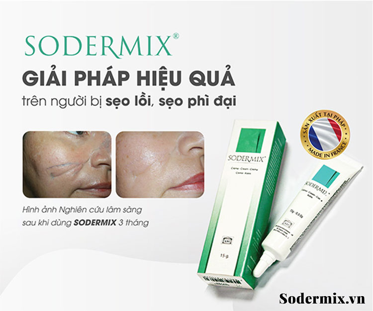 Trị sẹo lồi dễ dàng tại nhà với kem bôi Sodermix 1