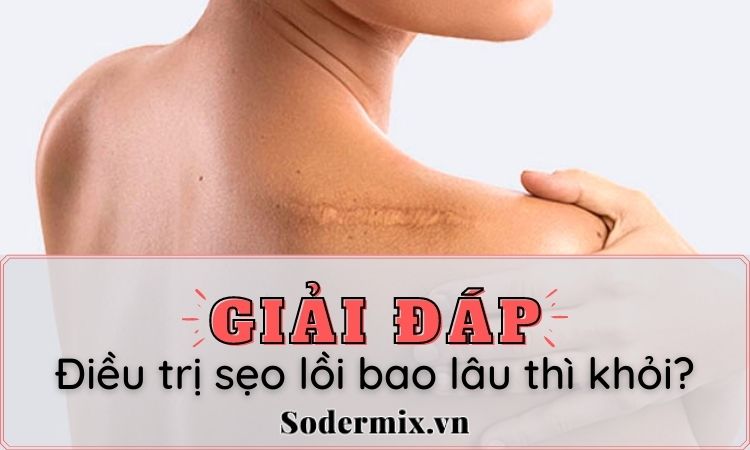 Giải đáp: Điều trị sẹo lồi bao lâu thì khỏi?