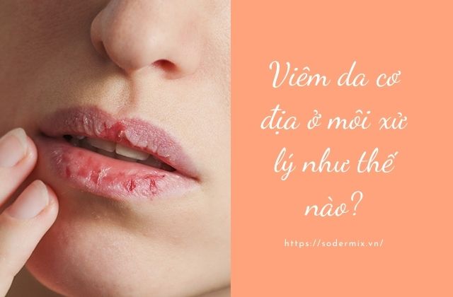 Viêm da cơ địa ở môi xử lý như thế nào?