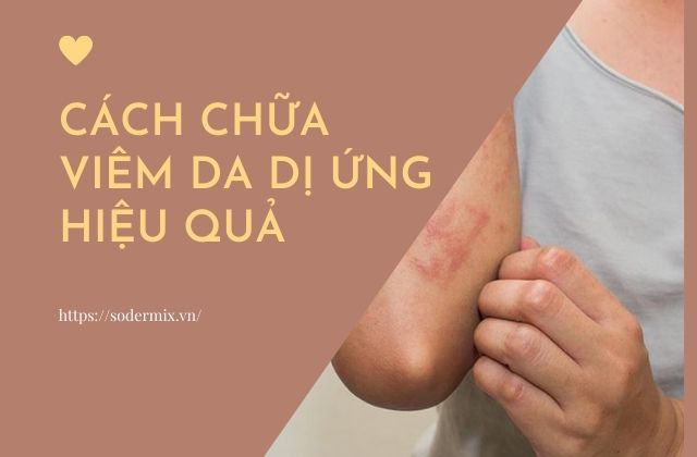 Mách cách chữa trị viêm da dị ứng hiệu quả