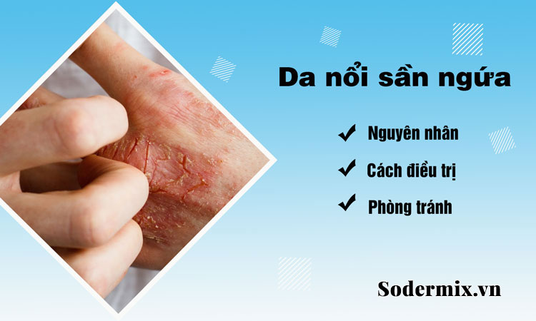 Da nổi sần ngứa: Nguyên nhân, cách điều trị và phòng ngừa