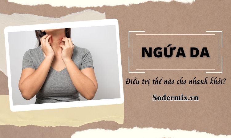 Nổi mẩn ngứa da là bệnh gì? Mách bạn cách điều trị hiệu quả!