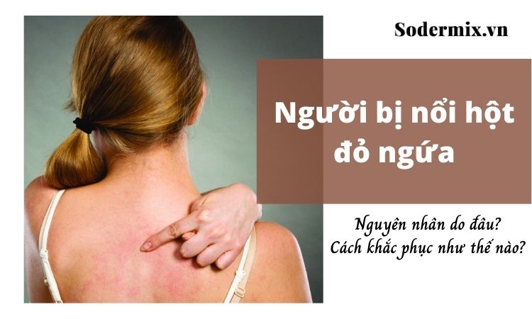 [GIẢI ĐÁP] Người nổi hột đỏ ngứa là bệnh gì? Cách chữa trị ra sao?