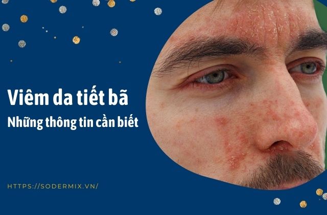 Viêm da tiết bã - Nguyên nhân, triệu chứng và cách điều trị hiệu quả