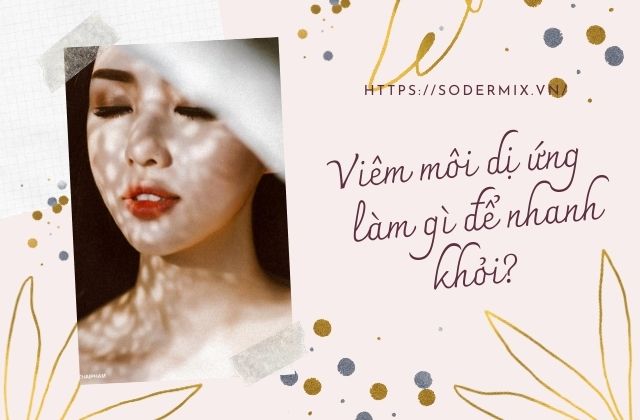 Viêm môi dị ứng -  làm gì để nhanh khỏi?