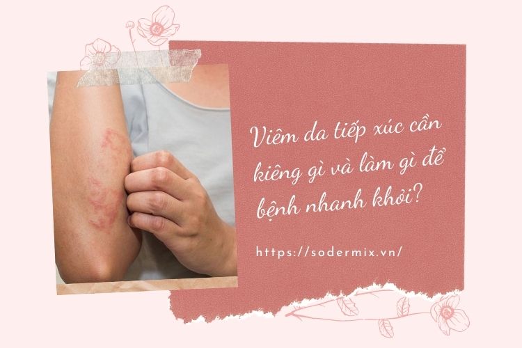 Viêm da tiếp xúc cần kiêng gì và làm gì để bệnh nhanh khỏi? 1