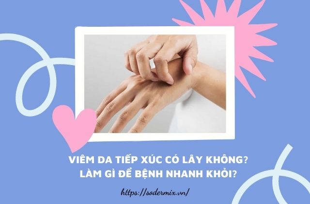 Viêm da tiếp xúc có lây không? Làm gì để bệnh nhanh khỏi?