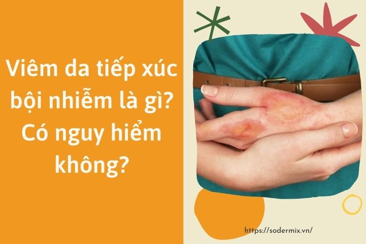 Viêm da tiếp xúc bội nhiễm là gì? Có nguy hiểm không?