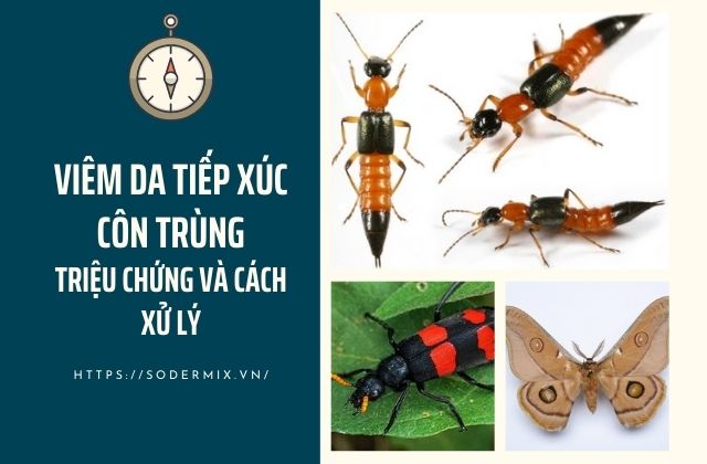 Viêm da tiếp xúc côn trùng - Triệu chứng và cách xử lý hiệu quả 1