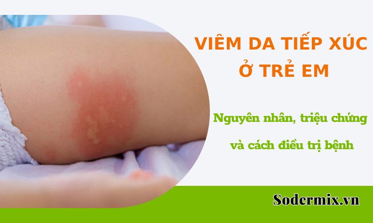 Viêm da tiếp xúc ở trẻ em: Nguyên nhân và điều trị