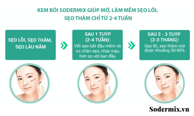 Sodermix có tác dụng mờ sẹo sau bao lâu? 1