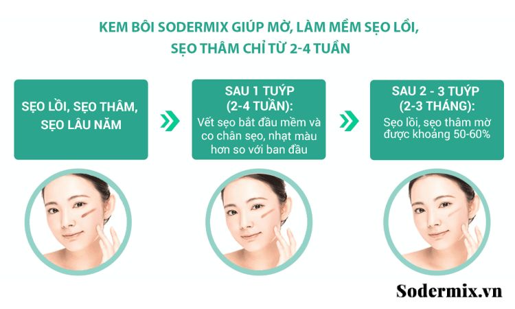 Dùng kem Sodermix trị sẹo lồi an toàn và tiết kiệm chi phí 2