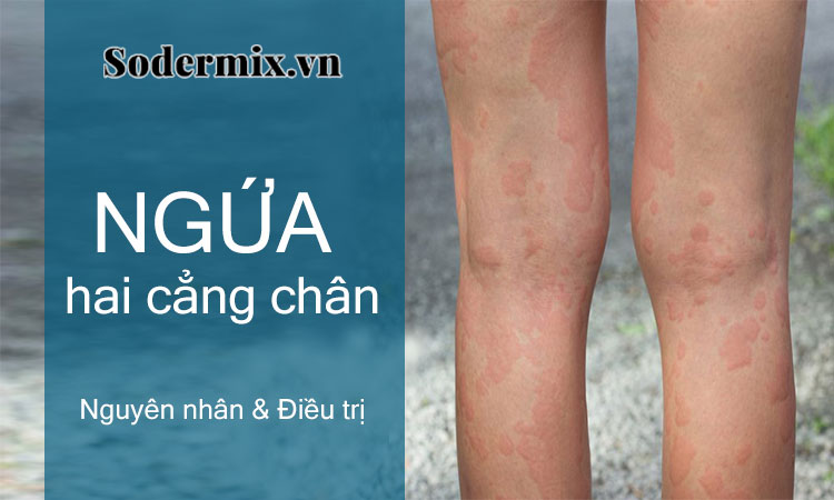 Ngứa ở hai cẳng chân - nguyên nhân và cách trị triệt để