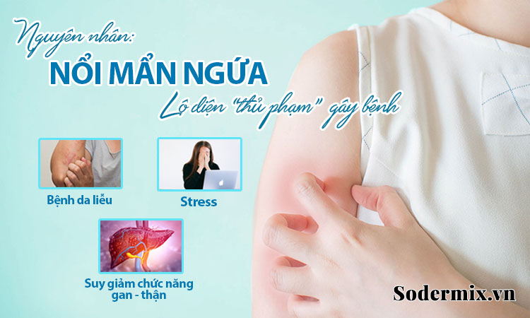 Nguyên nhân nổi mẩn ngứa: Lộ diện “thủ phạm” gây bệnh