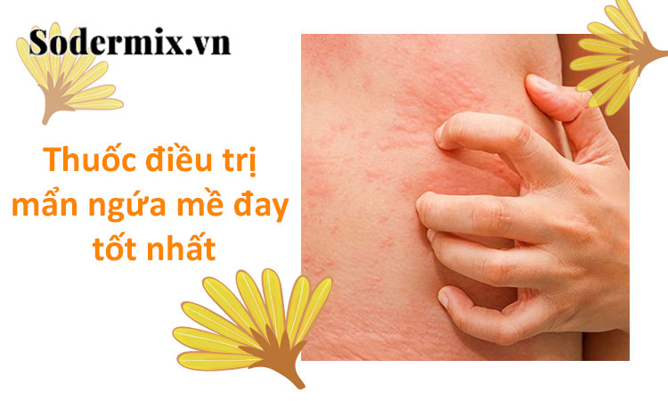 Mách cách lựa chọn thuốc trị mẩn ngứa mề đay tốt nhất! 1