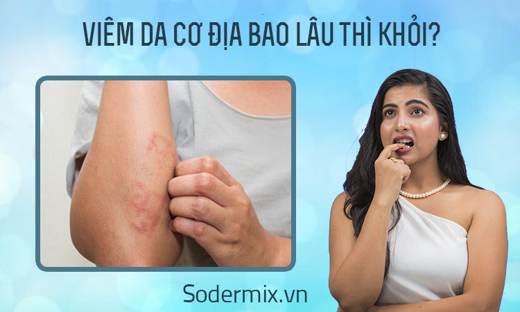 Bệnh viêm da cơ địa bao lâu thì khỏi? 1