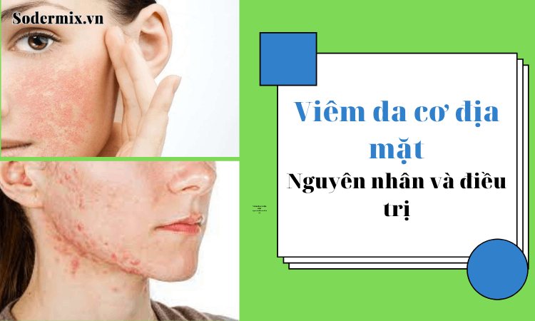 Viêm da cơ địa mặt: nguyên nhân và điều trị hiệu quả!