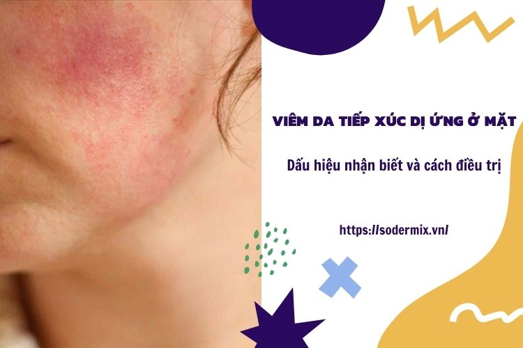 Viêm da tiếp xúc dị ứng ở mặt - Dấu hiệu nhận biết và phương pháp trị bệnh tối ưu