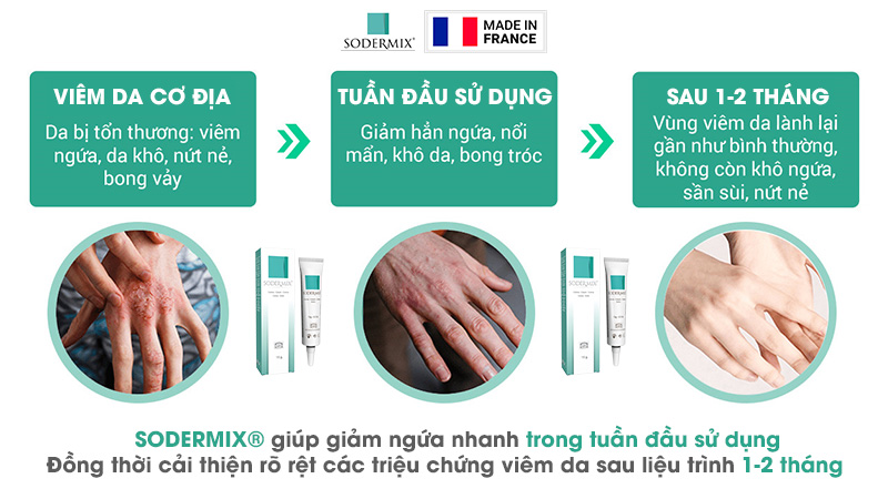 SODERMIX® KHÔNG CHỨA CORTICOID, cơ chế chống viêm, giảm ngứa hiệu quả 1