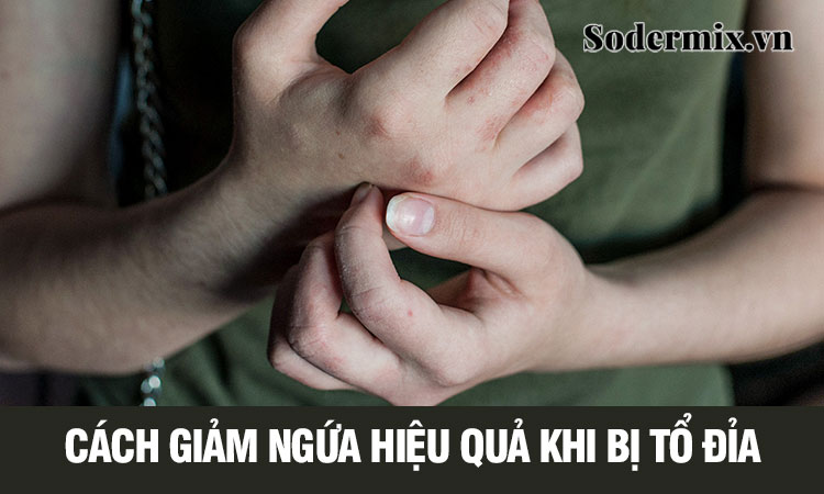 Mẹo giảm ngứa khi bị tổ đỉa nhanh hiệu quả! 1